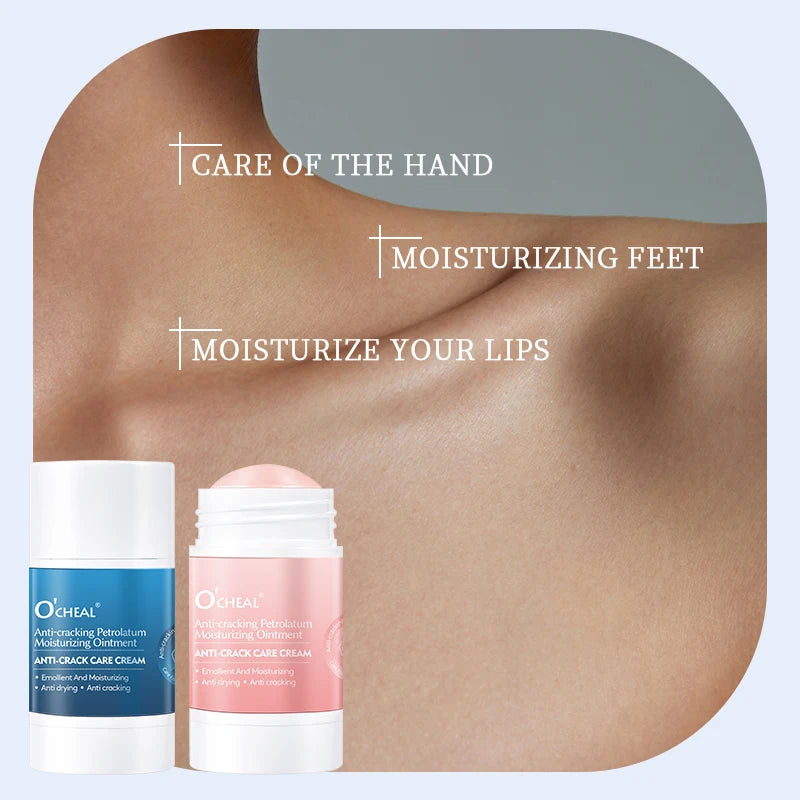 O’CHEAL 40g Foot Skin Care Cream Stick Nourishing Cream Hand Facial Cream Removal Dead Skin Moisturizing Hand Feet Gel Skin Care