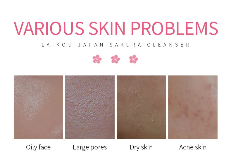LAlKOU Japan Sakura Gentle Cleansing Facial Cleanser Shrink Pores Deep Clean Oil Control Remove Blackhead Moisturizing Skin Care