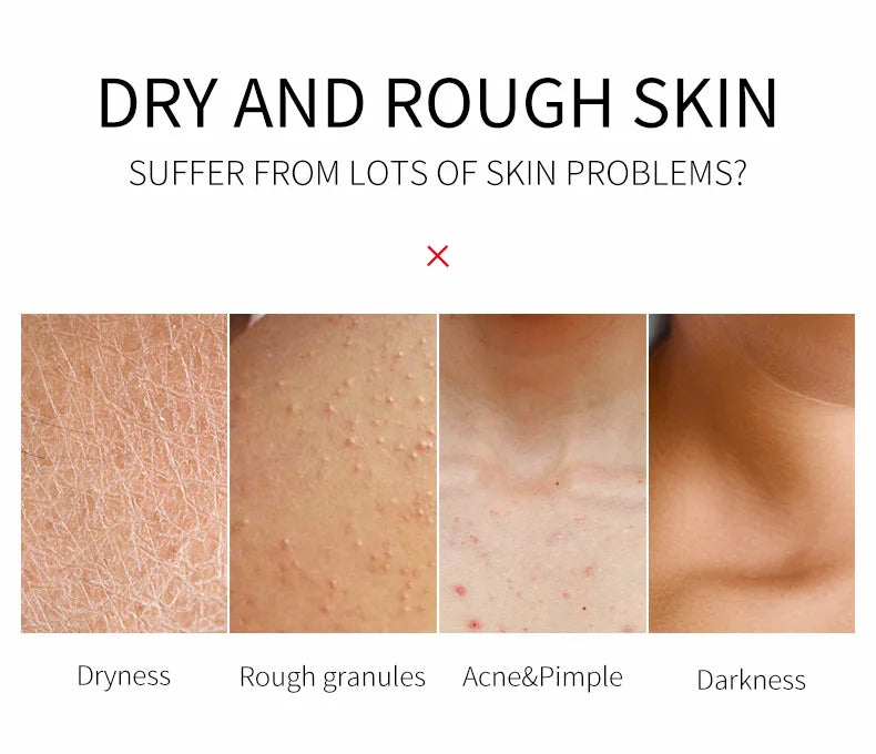 Shea Butter Exfoliating Scrub Cream Face Body Deep Pores Avocado Smooth Treatment Cleansing Wash Peach Acne Face Whitening
