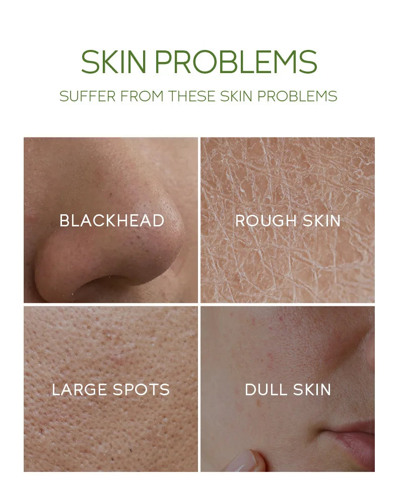 Facial Exfoliating Peeling Gel Face Scrub Moisturizing Whitening Green Tea Remove Blackhead Acne Detoxifies & Cleanses All Skin