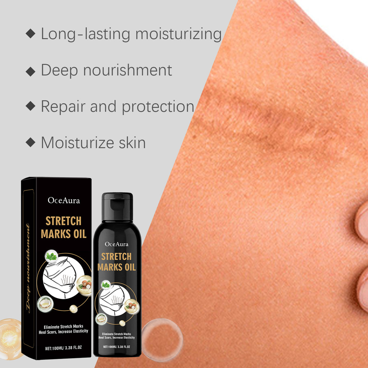 Stretch Marks Removal Oil Removes Postpartum Pregnant Women Scar Improve Sagging Smoothing Skin Whiten Repair Firming Skin Care