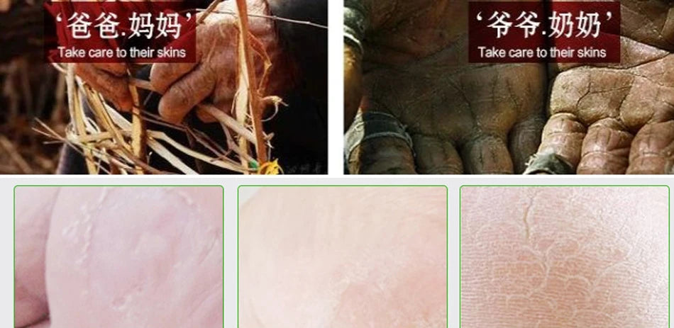 Effective Chinese Anti-Drying Crack Foot Cream Heel Cracked Repair Cream Removal Dead Skin Foot Mask Chapping Care 33/55/85g