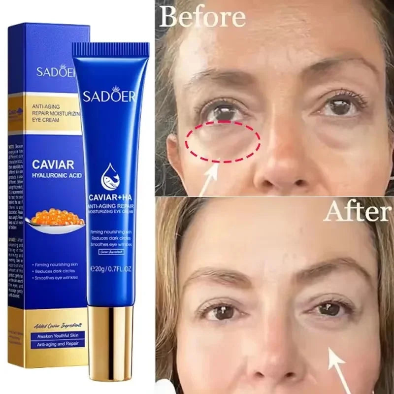 Caviar Eye Bag Removal Cream Hyaluronic Acid Anti-Wrinkle Firming Skin Fade Fine Lines Anti Dark Circle Puffiness Eye Care 20g
