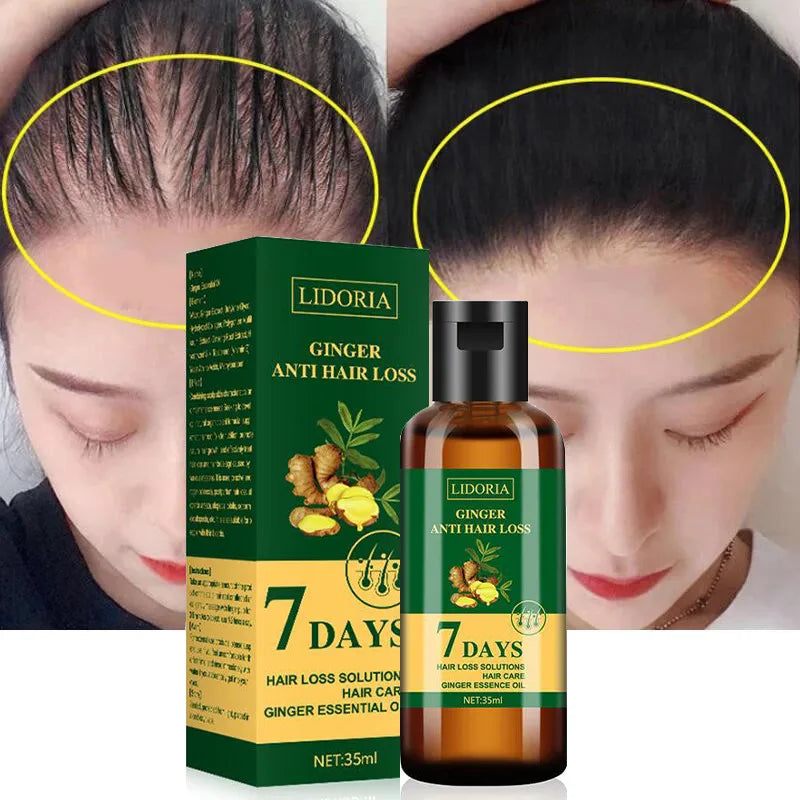 Ginger Hair Growth Essential Oil Natural Anti Hair Loss Products Fast Grow Prevent Baldness Treatment Germinal Liquid Men Women