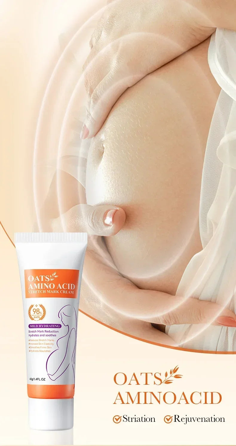 Powerful Stretch Marks Remover Pregnancy Cream Light Lines Removal Postpartum Obesity