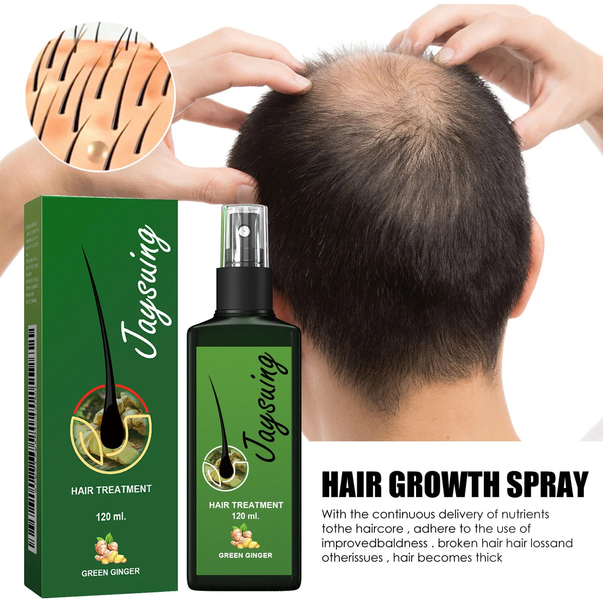 Hair Growth Spray Ginger Massage Scalp Damaged Treatment Solution Nourish Roots Fast Grow Anti Hair Loss Serum Beauty Health