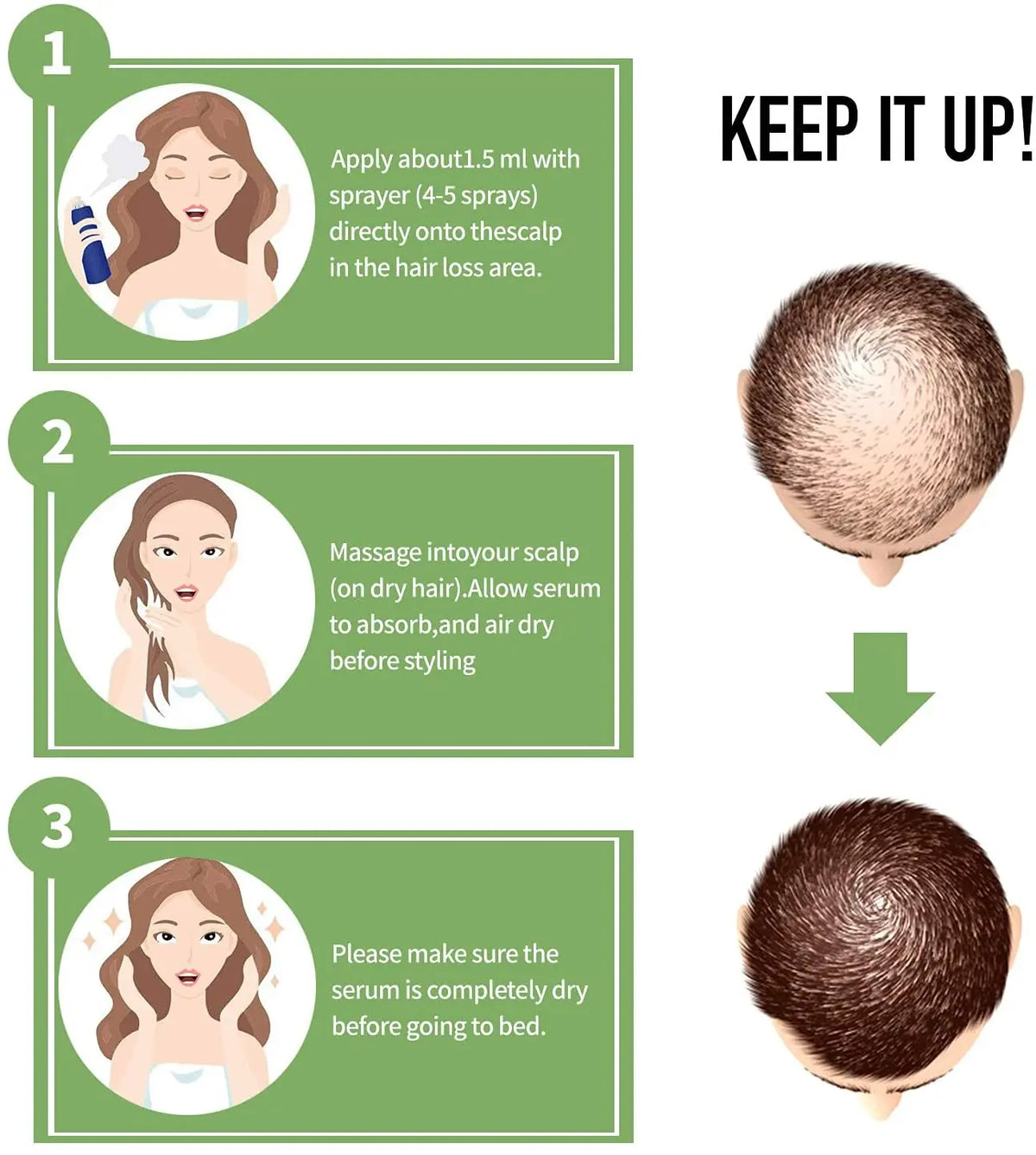 Ginger Hair Growth Essential Oil Natural Anti Hair Loss Products Fast Grow Prevent Baldness Treatment Germinal Liquid Men Women