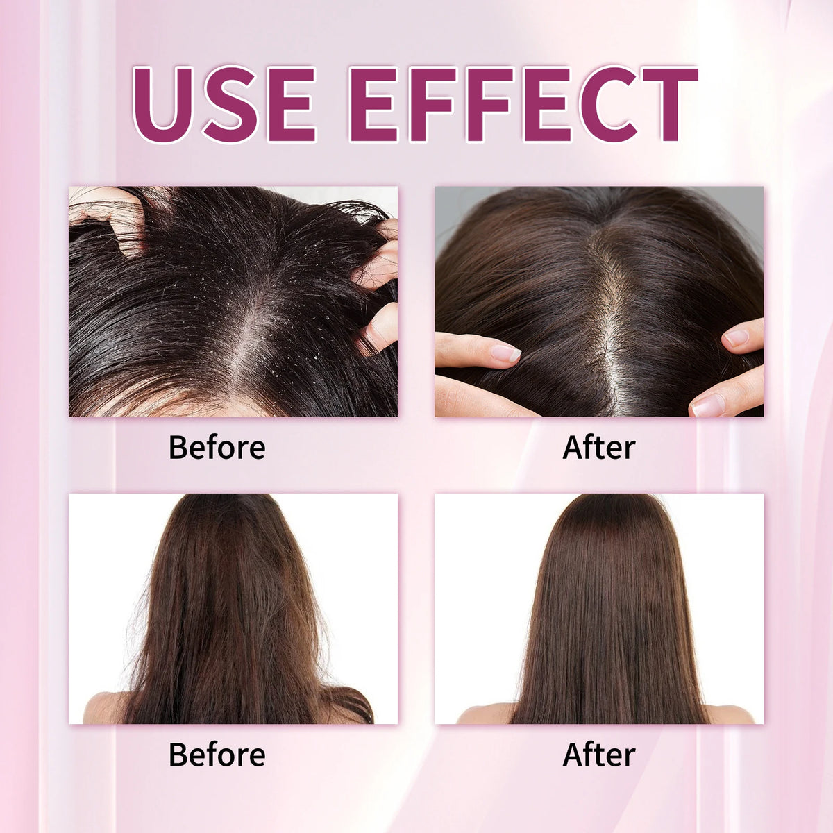 200ML Hair Shampoo Fast Hair Growth Rosemary Onion Hair Regrowth Shampoo Nourishing Anti Hair Loss Effective Hair Growth Product