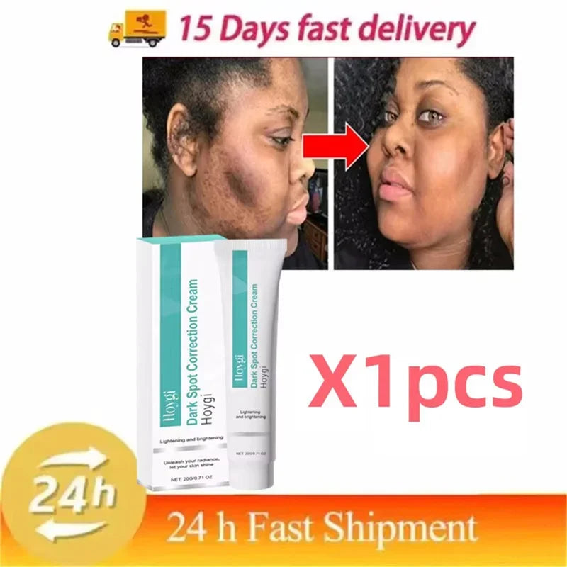Powerful Spot-removing Whiten Cream Brighten Skin Fast Eliminates Melanin Pigmentation Melasma Dark Spots Moisturize Beauty Gel