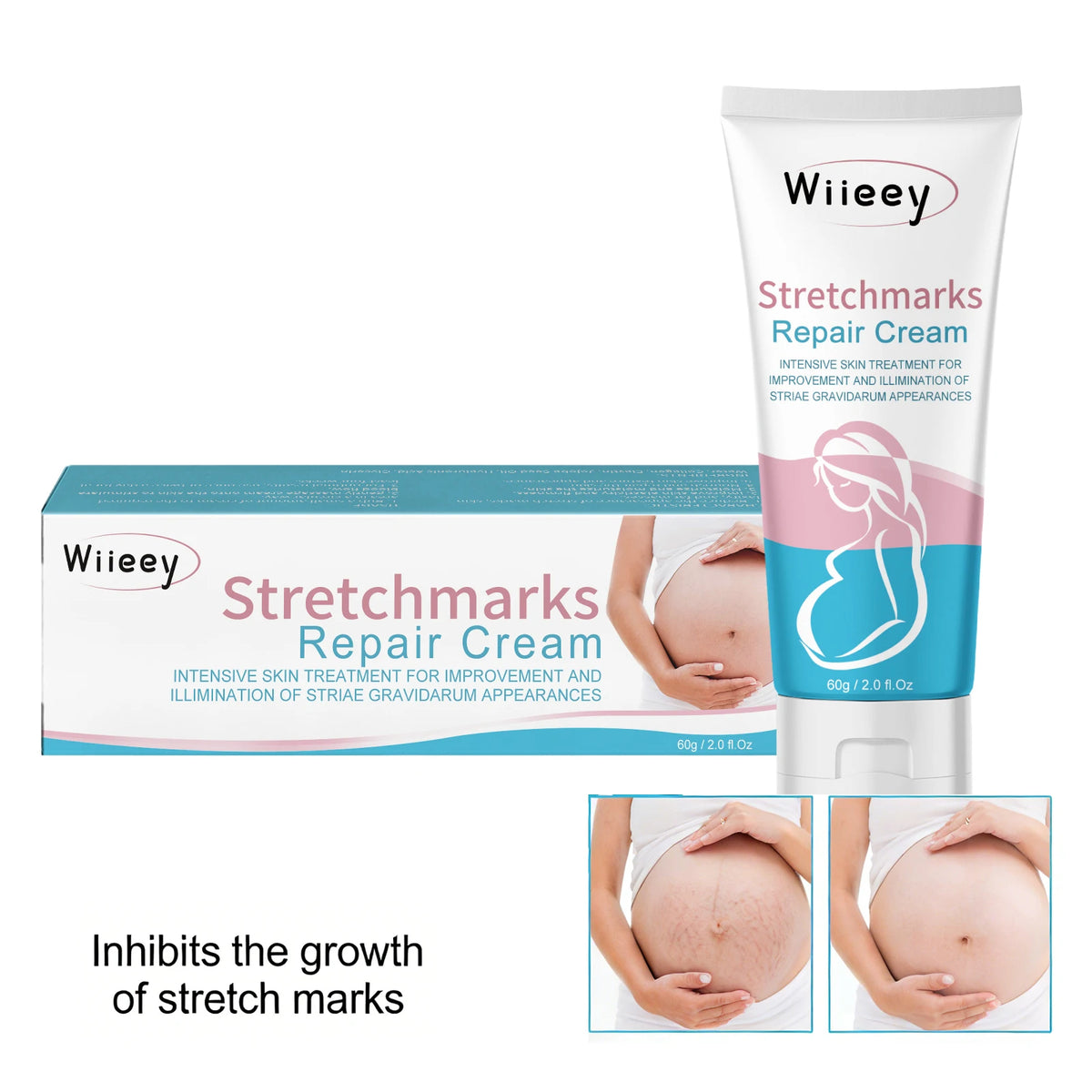 Stretchmarks Repair Cream Remove Pregnancy Firm Skin Enhance Elasticity Body Cream Nourish Moisturizing Pregnant Women Skin Care