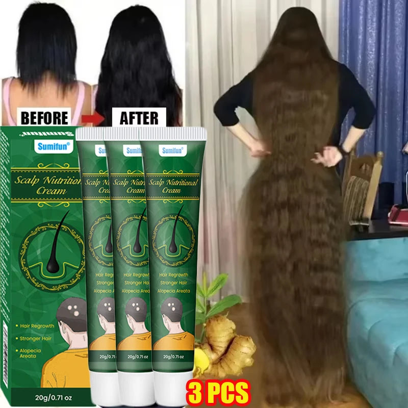 Fast Ginger Hair Growth Cream Anti Hair Loss Baldness Repair Damaged Scalp Treatment Nourish Hair Root Care Products Women Men