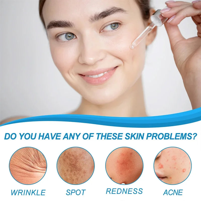 B5 Hyaluronic Acid Serum Facial Anti A-ging W-rinkle Lift Firming Fine Lines Lightening Dark Circle Skin Brightening Hyalu Serum