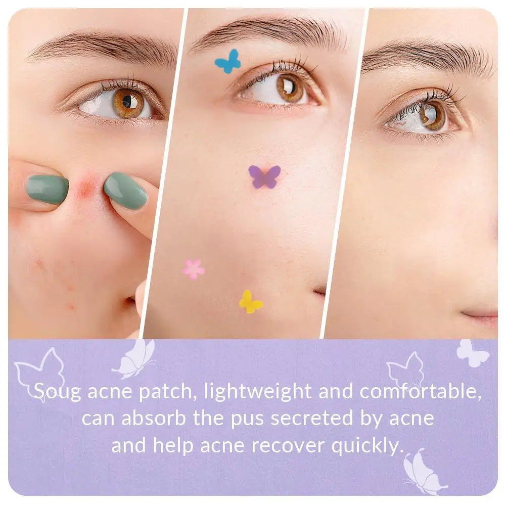 Butterfly Shape Acne Pimple Patch Stickers Blemish Spot Concealer Cover 0.1mm Acne Repair Pimple Remover Skin Care