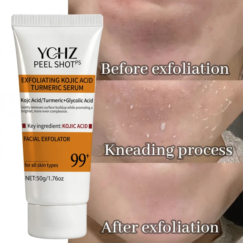 Turmeric Kojic Acid Exfoliating Gel Essence Suitable for Face and Body Gentle Orange Scented Facial Scrub Body Cleansing Gel Removes Dead Skin Scrub Skin Cleanser-50G