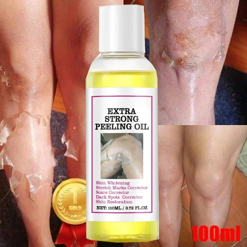 Yellow Peeling Lotion Oil 100% Organic Bleaching Dark Skin Exfoliating Whitening Nourishing Hyaluronic Acid Moisturiz Body Scrub