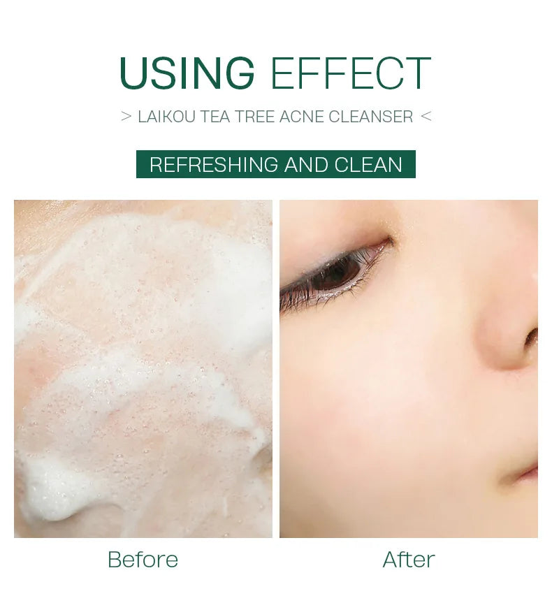 LAlKOU Japan Sakura Gentle Cleansing Facial Cleanser Shrink Pores Deep Clean Oil Control Remove Blackhead Moisturizing Skin Care