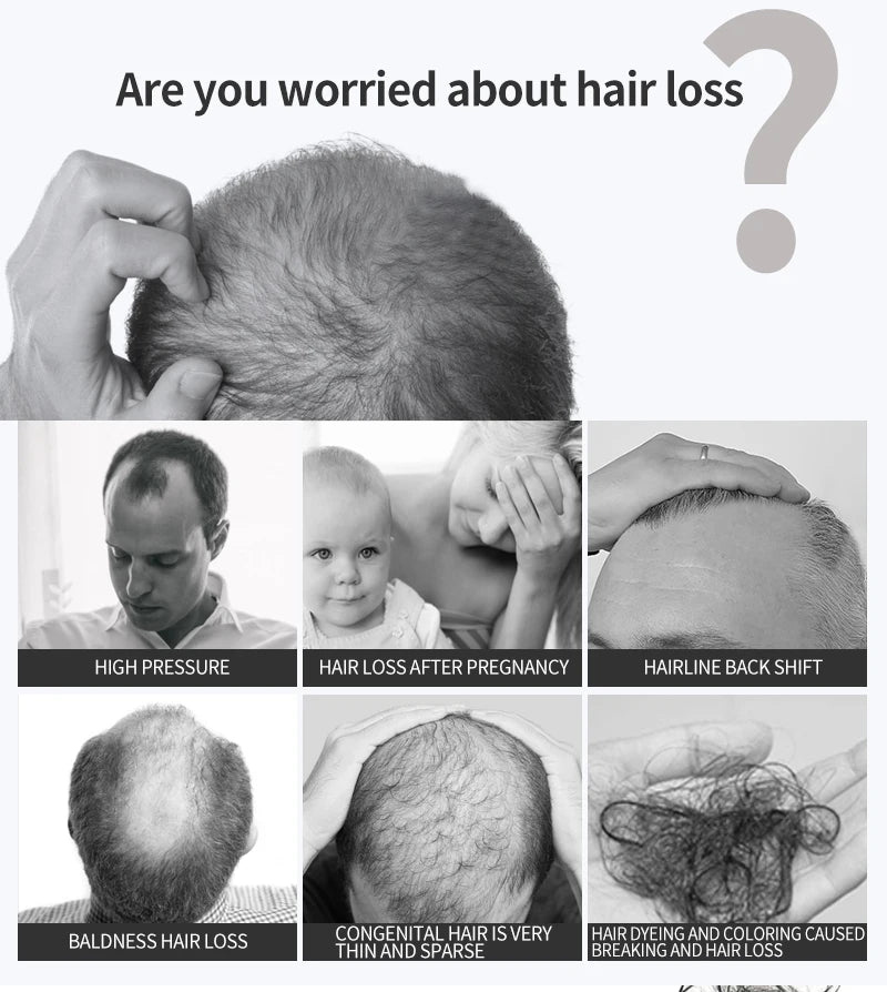 Ginger Hair Growth Essential Oil Natural Anti Hair Loss Products Fast Grow Prevent Baldness Treatment Germinal Liquid Men Women
