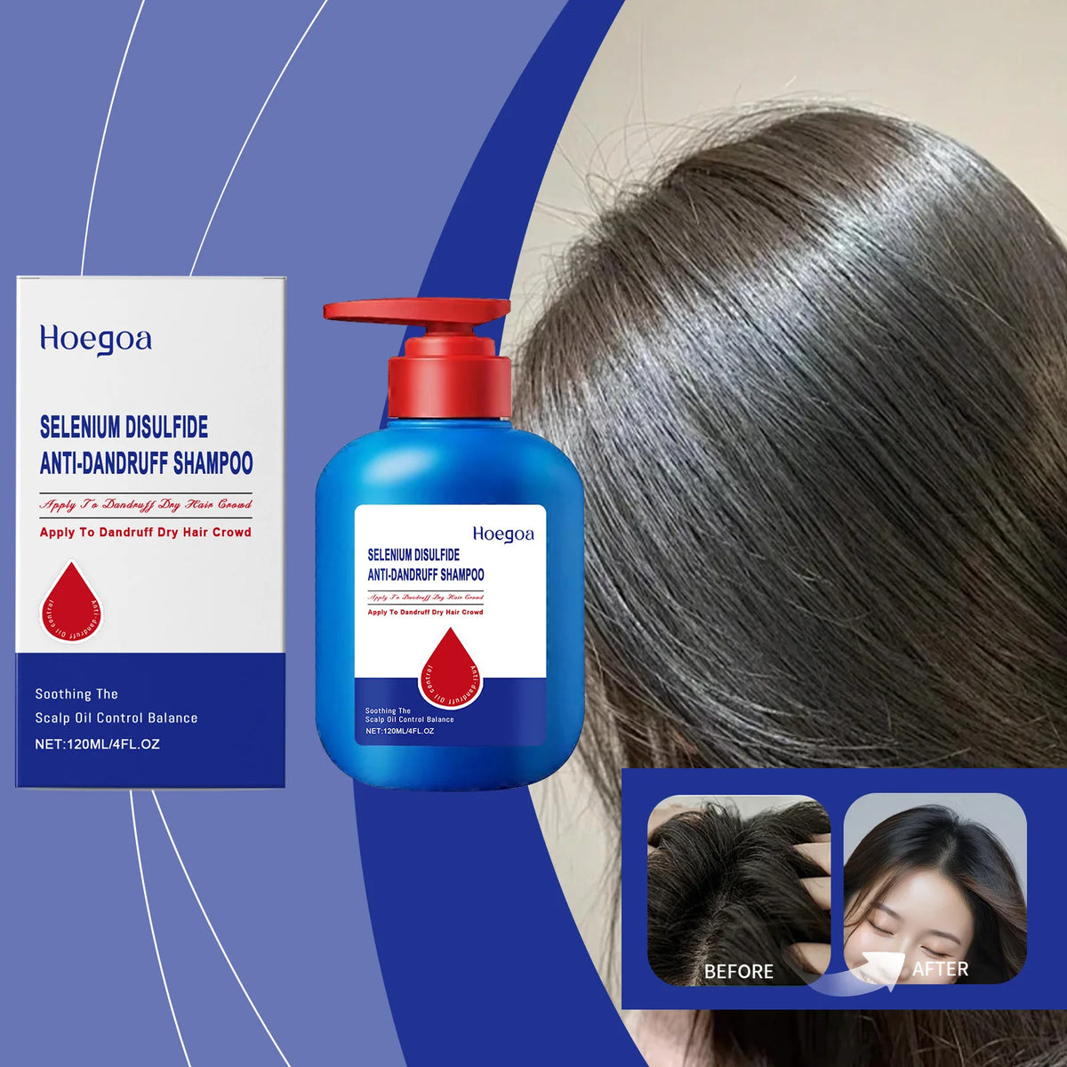 120ml Selenium Sulfide Shampoo Deep Cleansing Remove Dandruff Itchy Balance Oil Nourishing Restoration Hair Color Shampoo