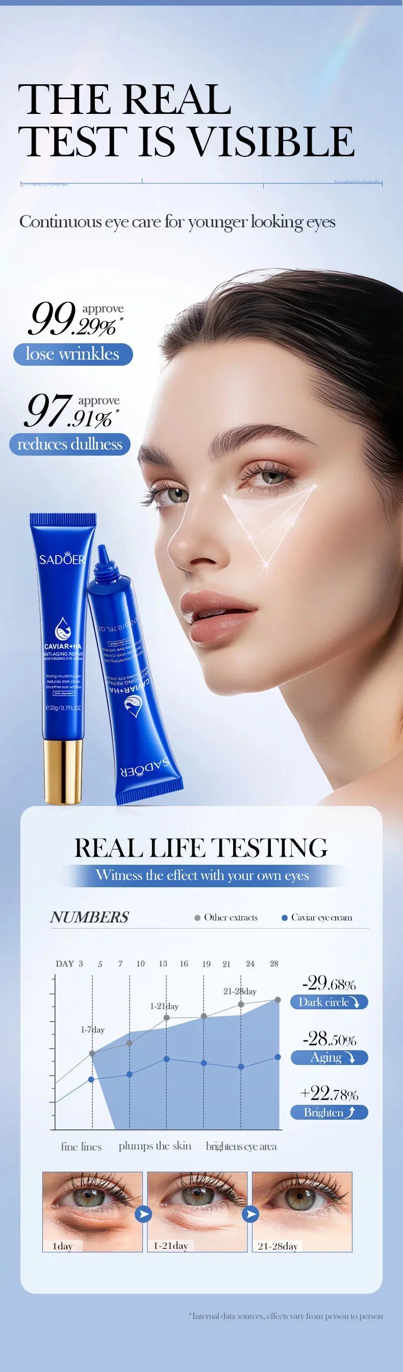 Caviar Eye Bag Removal Cream Hyaluronic Acid Anti-Wrinkle Firming Skin Fade Fine Lines Anti Dark Circle Puffiness Eye Care 20g