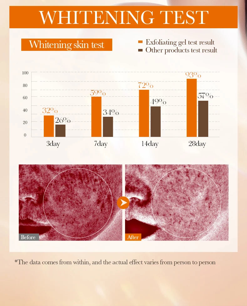 Orange Exfoliating Peeling Gel Facial Scrub Moisturizing Nourish Repair Scrubs Blackhead Removal Face Cleanser Korean Cosmetics