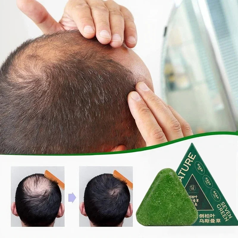 Arborvitae Leaf Shampoo Soap Strongly Fight Dandruff Strengthen Hair Root Effective Oil Control Prevent Hair Loss Solid Shampoo