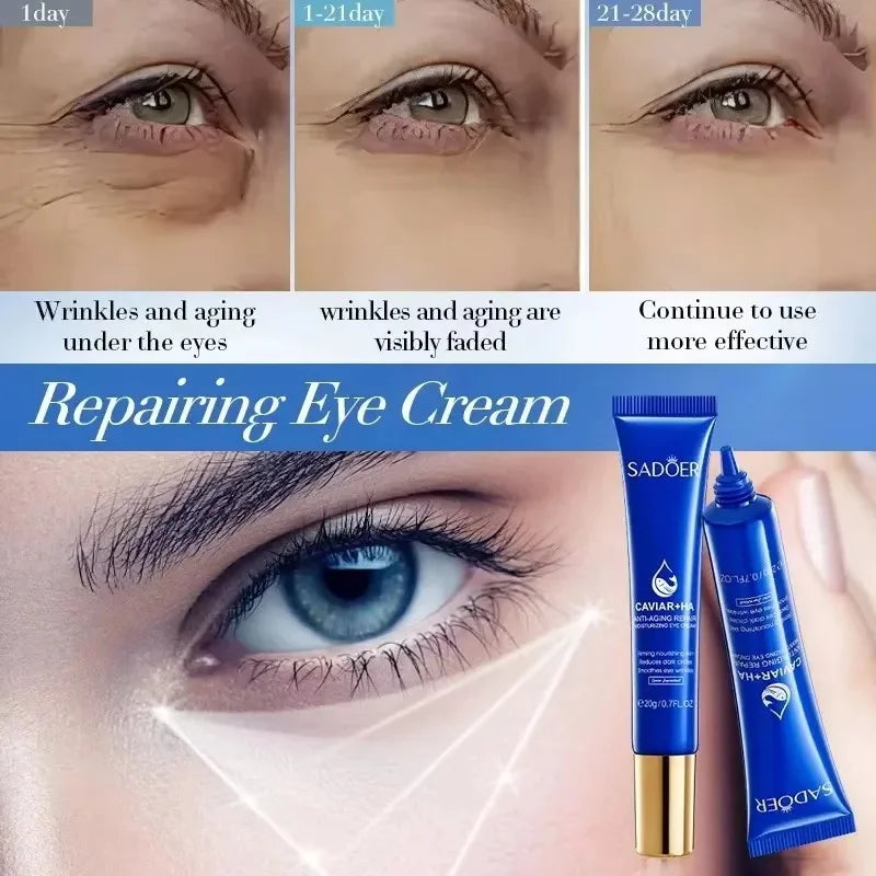 Caviar Eye Bag Removal Cream Hyaluronic Acid Anti-Wrinkle Firming Skin Fade Fine Lines Anti Dark Circle Puffiness Eye Care 20g