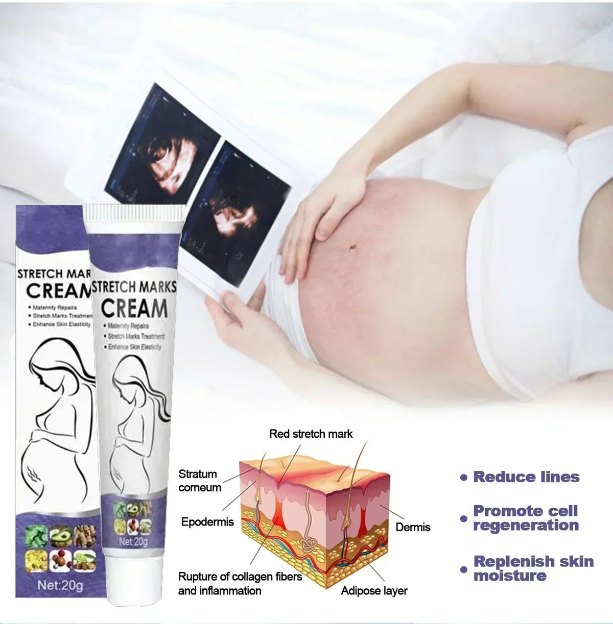 Stretch Mark Vanishing Cream Effective treatment Remove Body Buttock Breast Marks Repair Maternity Loose Firming Skin body Care