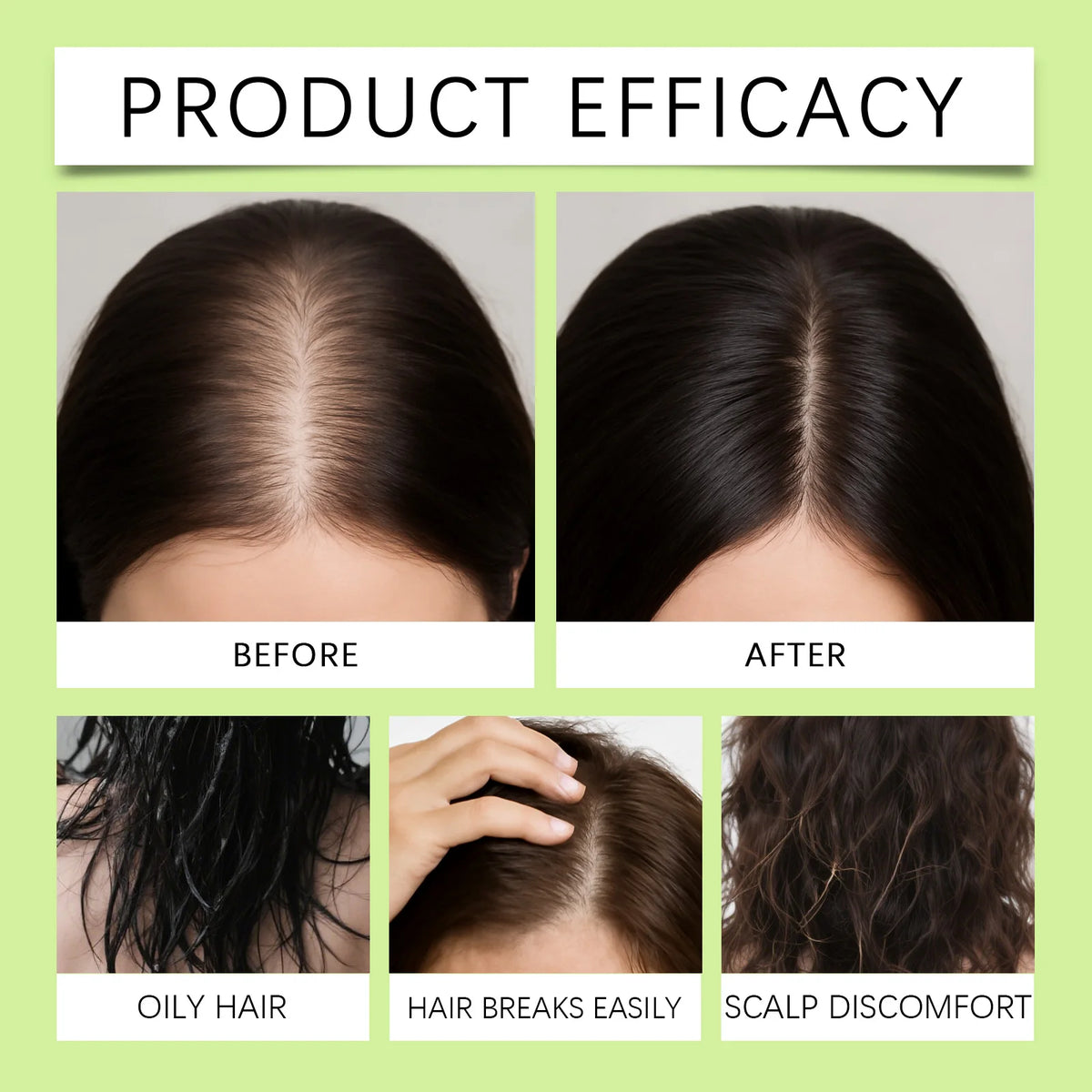 Nourishing Scalp Hair Serum Microneedle Roller Kit Reduce Hair Loss Strengthen Hair Roots Daily Care.