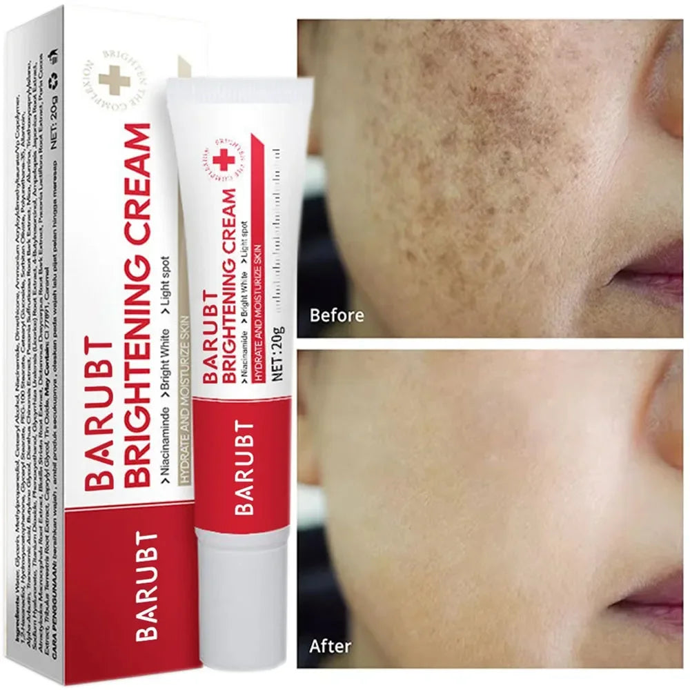 Whitening Freckles Face Cream Removal Melasma Dark Spots Corrector Lighten Melanin Pigmentation Brighten Anti-Aging Beauty Care