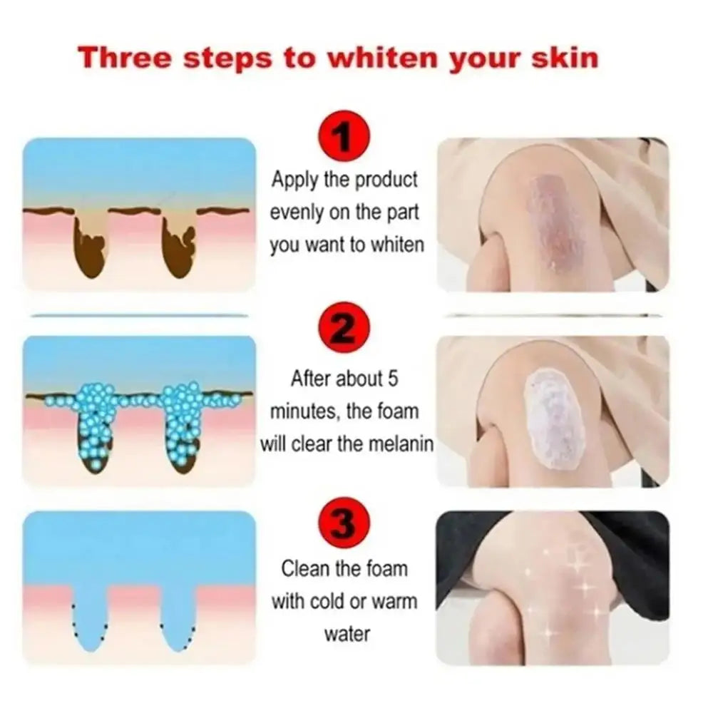 Whitening Cream For Dark Skin Underarm Bleaching Armpit Lightening And Intimate Area Woman Moisturizer Korean Skin Care Products