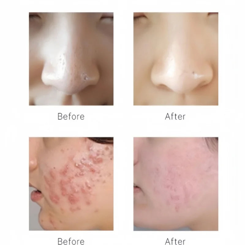 Aqua Peeling Serum Facial Essence Set for Beauty Machine Dermabrasion for Face Skin Care Exfoliate Moisturizing Deep Cleaning