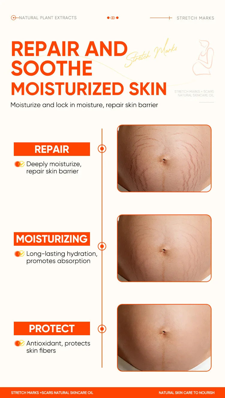 150ml Vitamin E Skin Care Oil Remove Pregnancy Stretch Marks Postpartum Care Elastic Skin Firming Collagen Body Care Oil