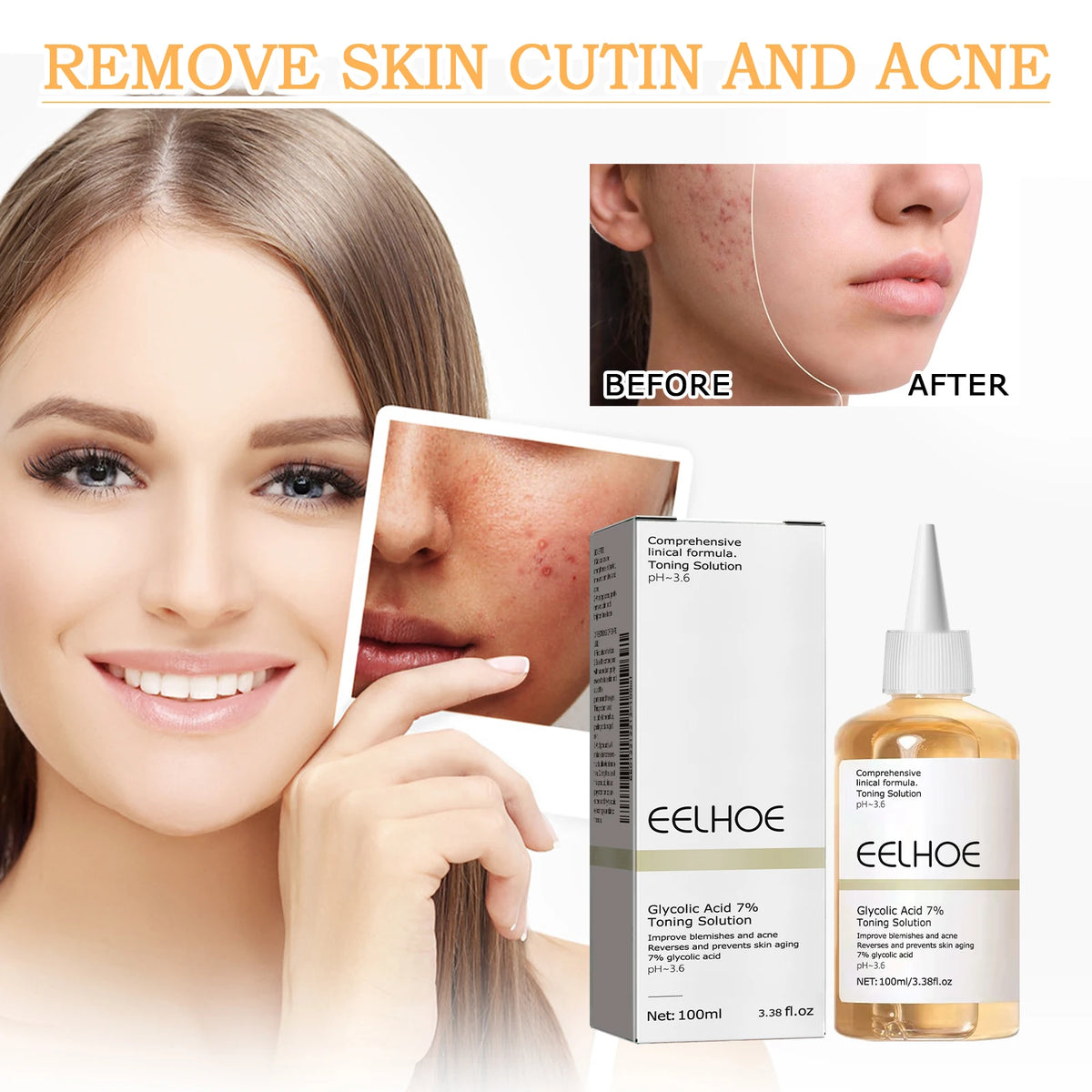 Glycolic Acid 7% Toning Solution Exfoliating Toner Pore Minimizer Skin Smoothing Brightening Even Tone Daily Facial Skincare