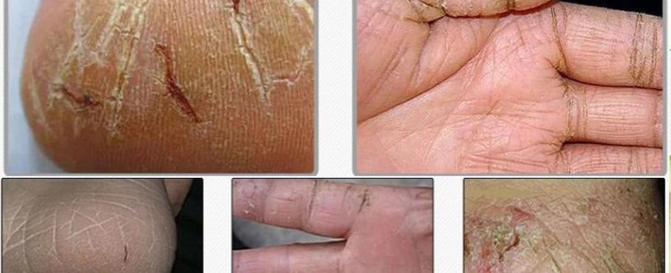Effective Chinese Anti-Drying Crack Foot Cream Heel Cracked Repair Cream Removal Dead Skin Foot Mask Chapping Care 33/55/85g
