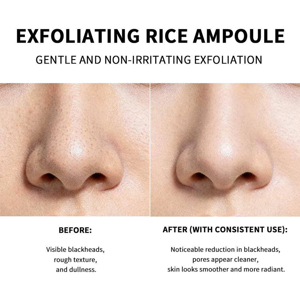 White Black Rice Peeling Essence Exfoliating Moisturizing Exfoliating Hydrating Serum Moisturizing Rice Toner Gentle Skin Care
