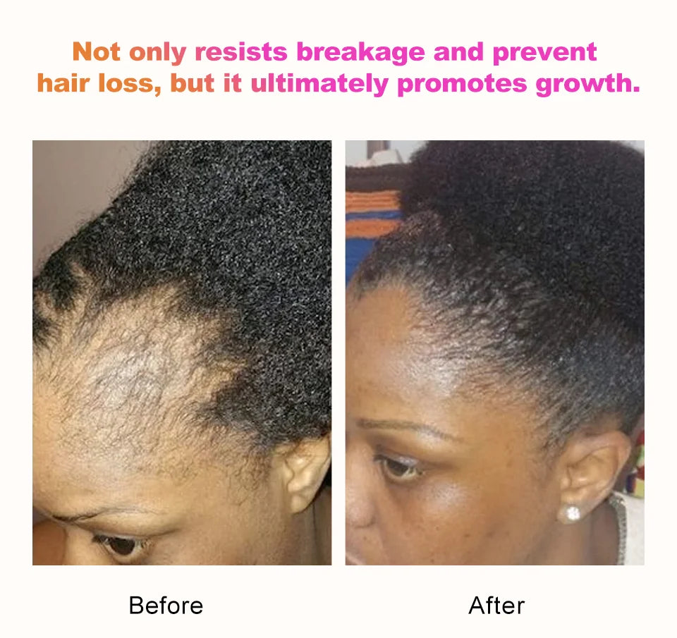 100% Natural Chebe Powder Natural Ingredients Promotes Hair Strengthens & Thickens Anti Hair Loss Hair Regrowth Treatment