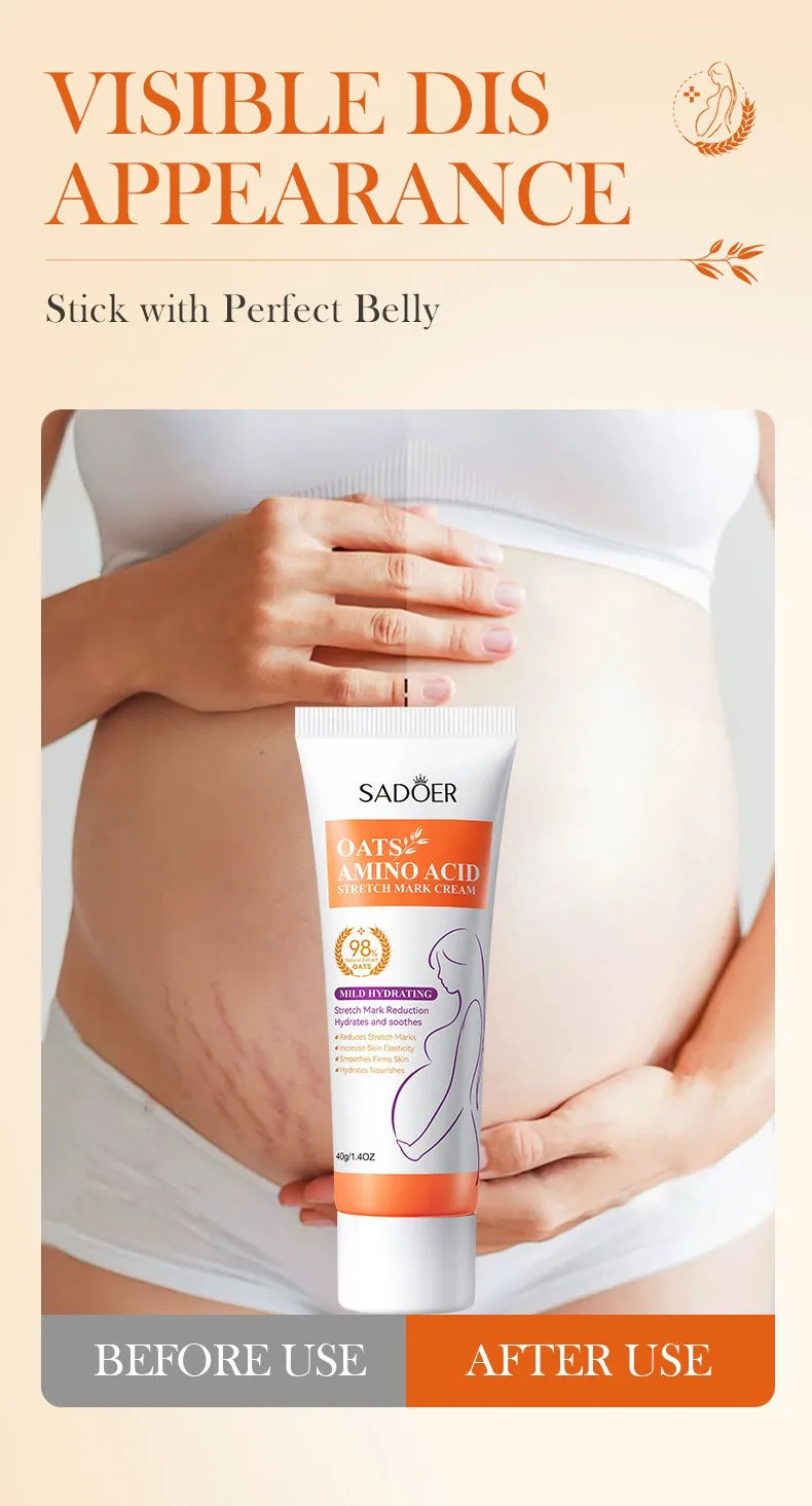 40g Removes Stretch Mark Cream To Remove Postpartum Obesity Pregnant Women Repair Anti-Aging Winkles Firming Body Cream SkinCare