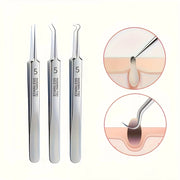 Stainless Steel Tweezers, Facial Blackhead Remover Set - 3-Piece Set With Storage Box, Ultra-Sharp, Cleans Facial Pores