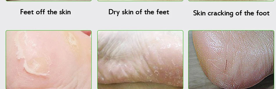 Effective Chinese Anti-Drying Crack Foot Cream Heel Cracked Repair Cream Removal Dead Skin Foot Mask Chapping Care 33/55/85g