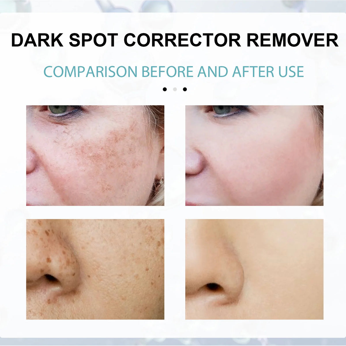 Retinol Whitening And Spot Removing Cream Softens Fine Lines & Wrinkles Repairs Skin Barriers Moisturizing And Brightening Face