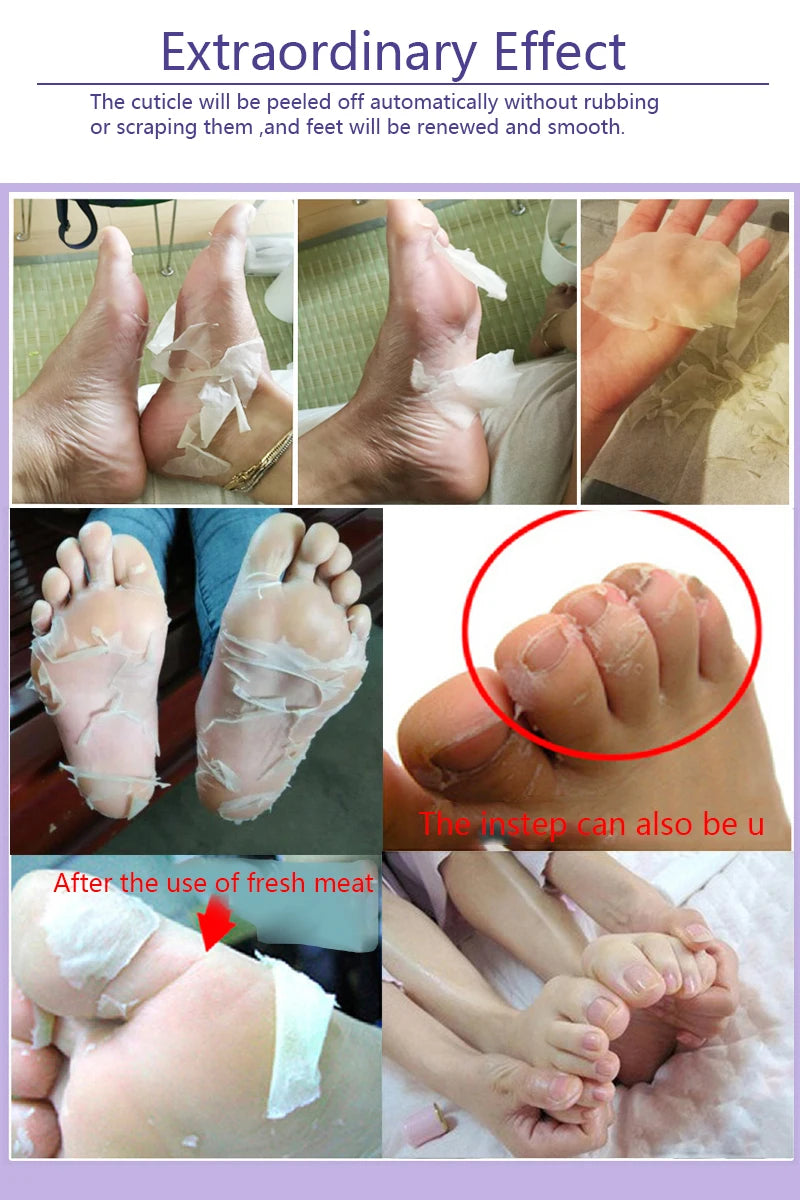 Lavender & VC Foot Peeling Mask Exfoliating Heels Calluses Remove Foot Patches Dead Skin Remover Pedicure Socks Foot Care 1Pair