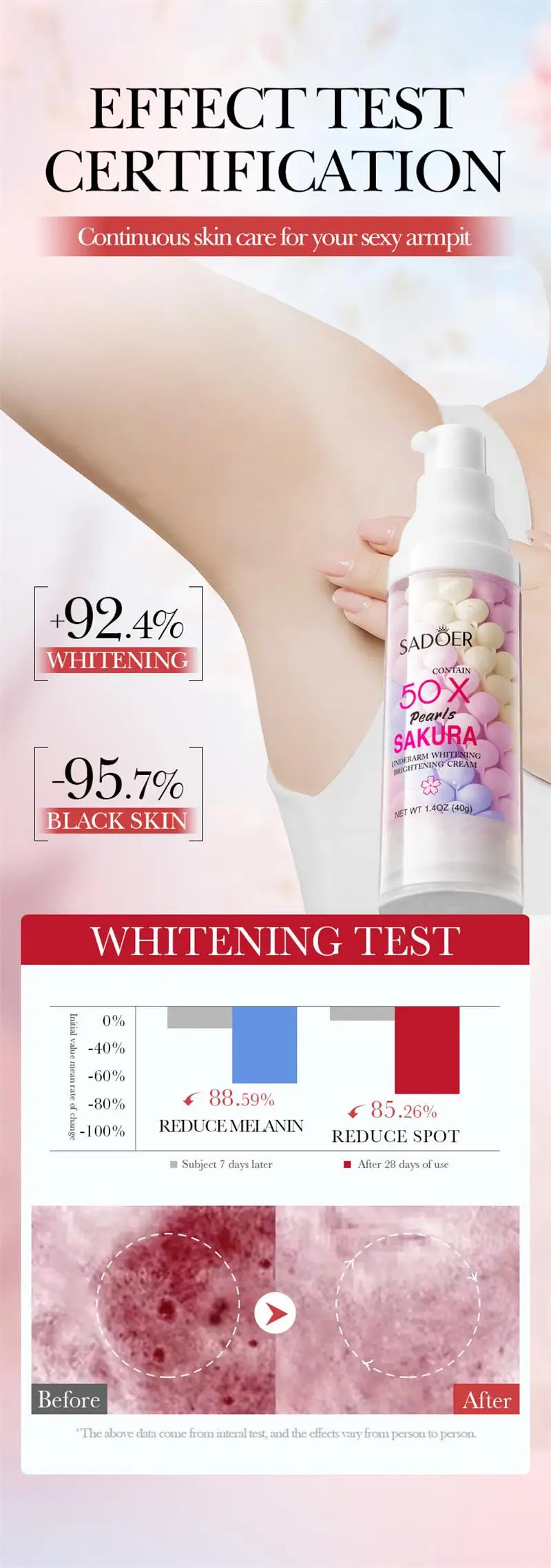 Whitening Cream Private Parts Underarm Bleaching Serum Whiten Butt Knee Brighten Inner Thigh Intimate Parts Dark Remove Melanin
