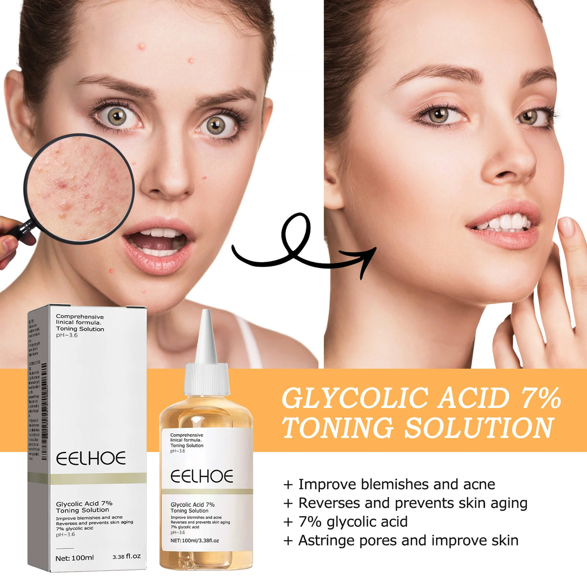 Glycolic Acid 7% Toning Solution Exfoliating Toner Pore Minimizer Skin Smoothing Brightening Even Tone Daily Facial Skincare