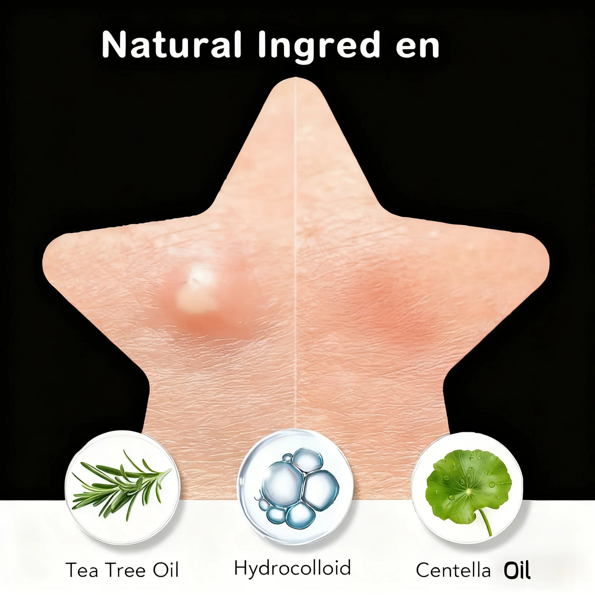 Bulk Pack Black Star Shaped Hydrocolloid Pimple Patches 240/480/800pcs Natural Tea Tree Oil Acne Stickers Invisible Blemish Cove