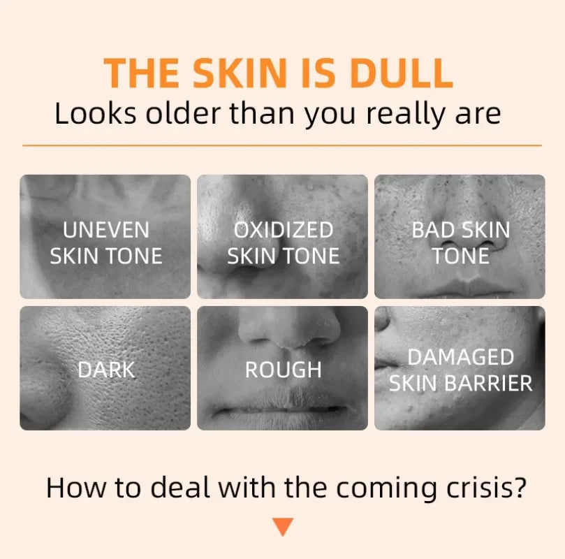 Orange Exfoliating Gel Dead Spot Remover Brighten Peeling 50g Gentle Repair Scrub Whiten Hydrating Moisturizer Korean Skin Care