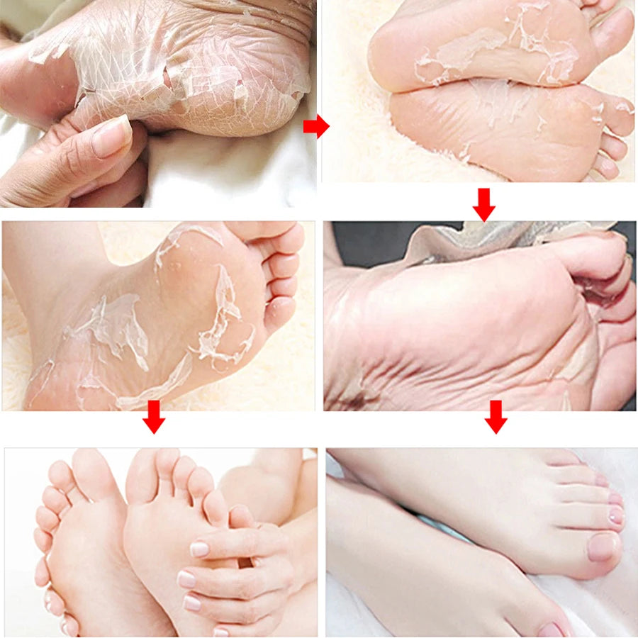 Lavender & VC Foot Peeling Mask Exfoliating Heels Calluses Remove Foot Patches Dead Skin Remover Pedicure Socks Foot Care 1Pair