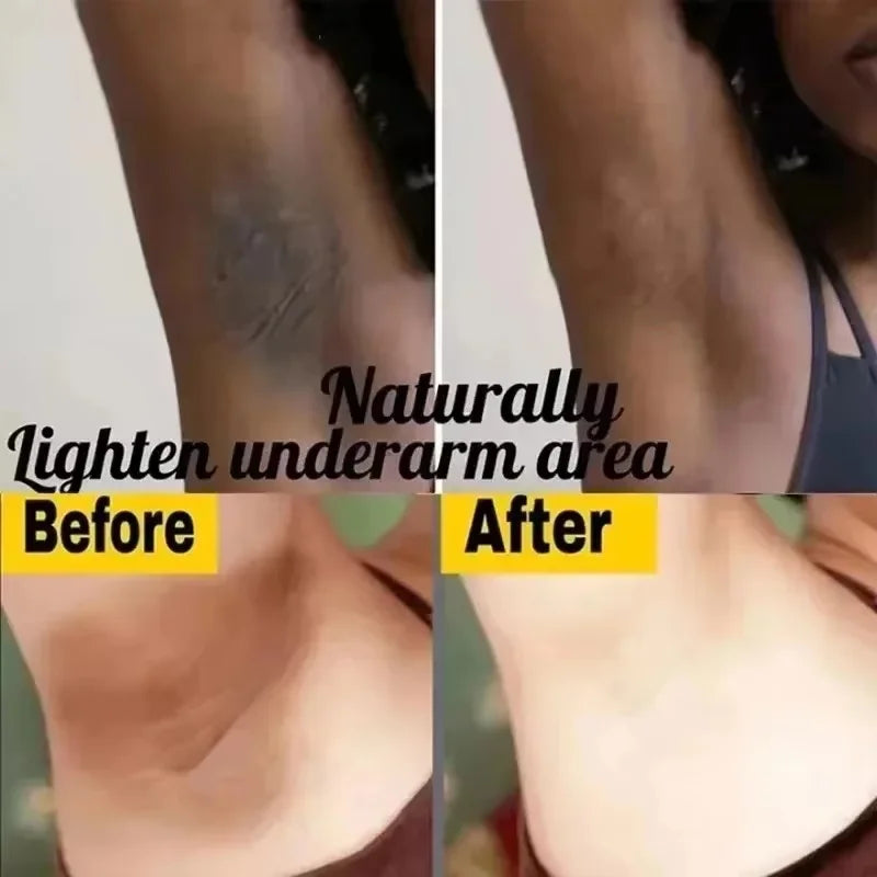 Body Whitening Cream Dark Skin Armpit Lightening Intimate Areas Underarm Bleaching Private Parts Whiten Cream Body Lotion Beauty