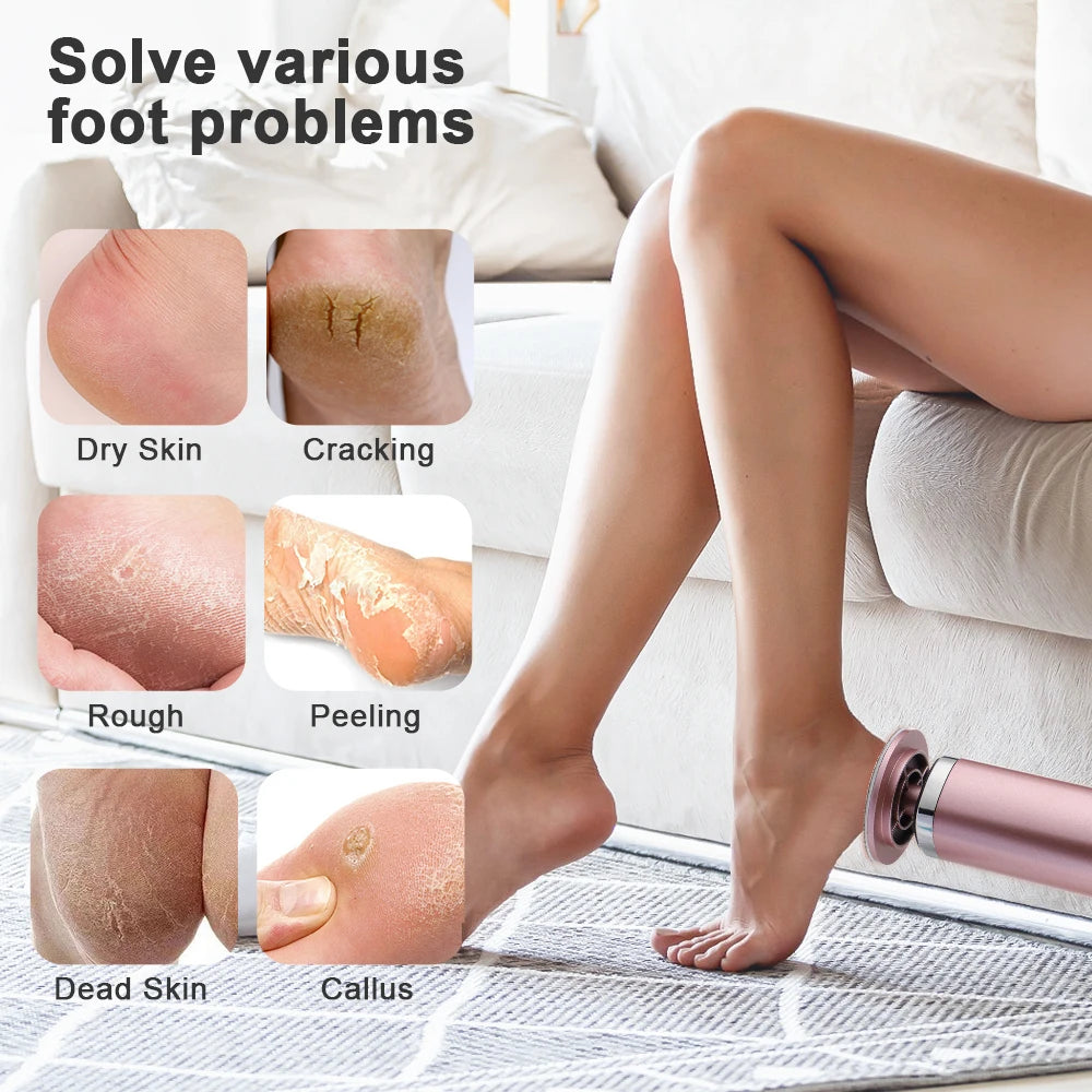 USB Rechargeable Wireless Electric Foot File Cuticle Callus Remover Machine Pedicure Tools Foot Heel Care Tool With Sandpaper