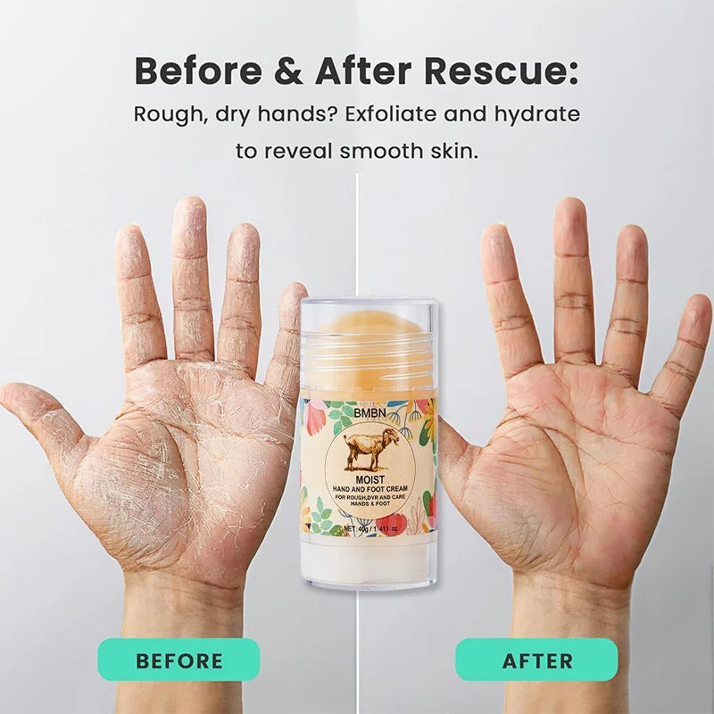 Moist Hand Foot Cream For Rough Dry Skin Deeply Repairs Cracked Skin Moisturizes Ingredient Lanolin Protective Stick Hand Cream