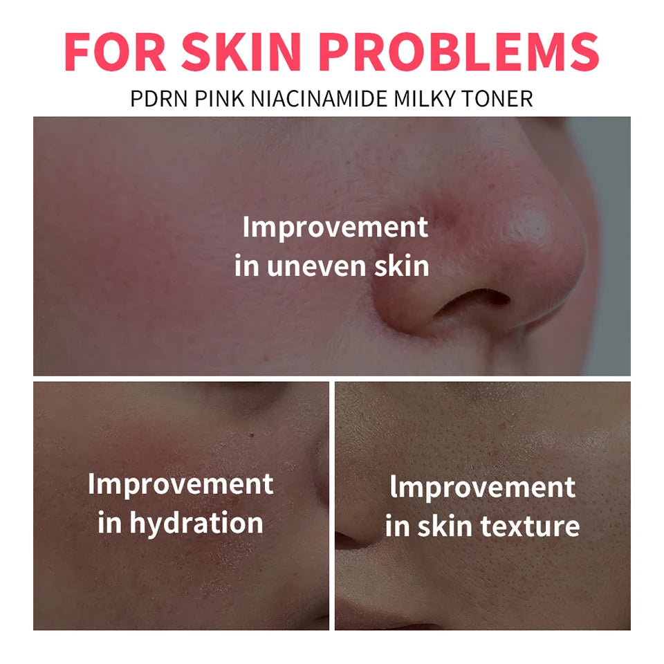 100ml PDRN Niacinamide Essence Toner For Glowing Skin Soothing Moisturizer Deep Nourishing Brightening Facial Water Lotion